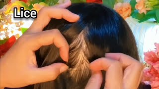 ASMR Satisfying I will help remove your fleas  No Talking 😴💤🥱 [upl. by Eilitan]