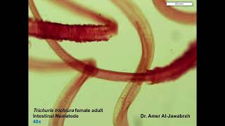 Trichuris trichiura Adult Female Intestinal Nematode [upl. by Ynalem]