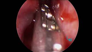 Rinoscopia en perro con masa biopsia en paralelo [upl. by Esil37]