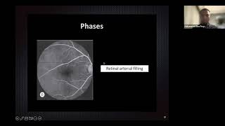 Retinal Vascularization amp FFA Mohammad Eko Prayogo [upl. by Brownson]