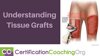 Understanding Tissue Grafts [upl. by Gollin]