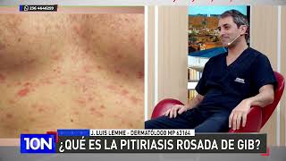 ¿Qué es la pitiriasis rosada de gib [upl. by Doe]