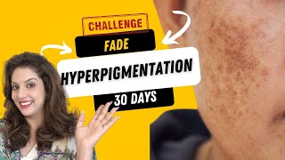 Incredible 30Day Hyperpigmentation Removal Remedy at Home  Nipun Kapurs Expert Skincare Routines [upl. by Spiro]