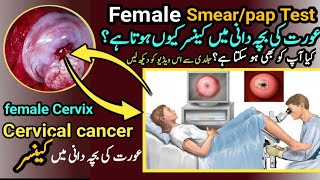 pap smearpap Test performedcervical cancer in females uteruspower [upl. by Ynatsyd]