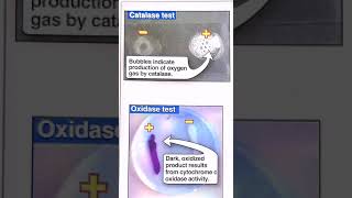 Catalase and oxidase test [upl. by Maryrose]