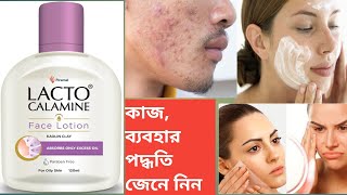 Lacto Calamine face lotion use  Review in Bengali [upl. by Anilec105]