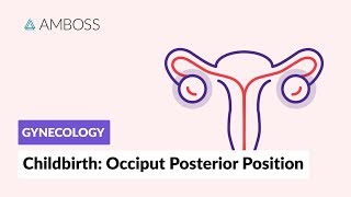 Gynecology Childbirth  Occiput Posterior Position [upl. by Utir]