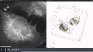 Gold nanoparticles internalized by HUVEC cells [upl. by Ytsud107]