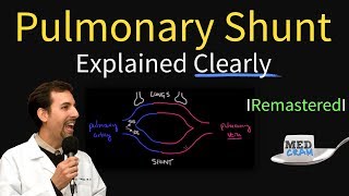 Shunting Explained Clearly Pulmonary Shunt  Remastered [upl. by Nylirem543]