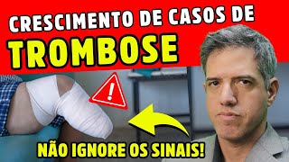 TROMBOSE SINAIS E SINTOMAS QUE VOCÊ NÃO PODE IGNORAR Dr Alain Dutra [upl. by Onahpets]