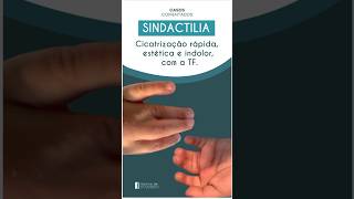 SINDACTILIA Cicatrização rápida estética e indolor com a TF [upl. by Akahs994]