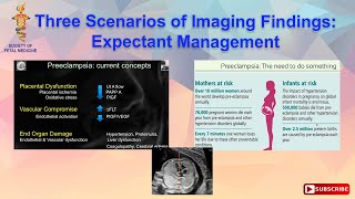 Three Scenarios of Imaging Findings Expectant Management [upl. by Donnell688]