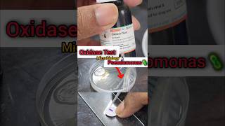 Oxidase Test 🧫🧪🔬🦠 Biochemicaltest  Microbiology Lab  Basics biochemistry shorts microbiology [upl. by Jeffy]