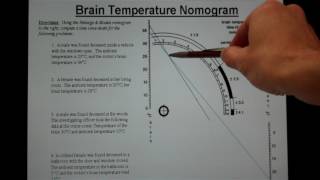 Brain Temperature Nomogram [upl. by Nacim]