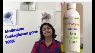 HOW TO TREAT MOLLUSCUM CONTAGIOSUM TRY Dr Wheatgrass skin recovery spray works 100 [upl. by Letnuahc]