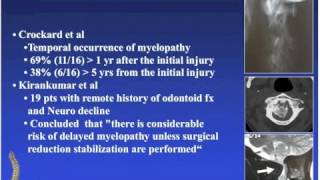 Spine Odontoid Fractures Overview and Surgical Treatment [upl. by Ecyor905]