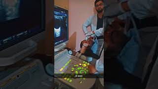 EYE ULTRASOUND B SCANyoutubeshortsviralshortsvideoviralviews [upl. by Ttezzil]