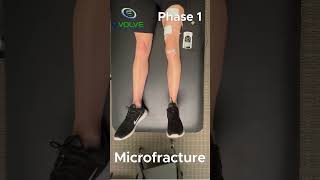 The Best Quadriceps Strengthening Exercise In Phase 1 Of Microfracture Rehab [upl. by Leuname761]