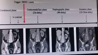 CT SCAN INTERVIEW WITH NCCT KUB CECT KUB UROGRAPHY [upl. by Walworth]