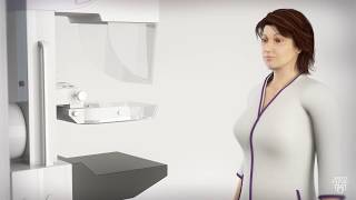 Mammogram for Breast Cancer  What to Expect [upl. by Atnoid]