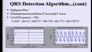 ECG Analysis 1 QRS Detection [upl. by Matheny]