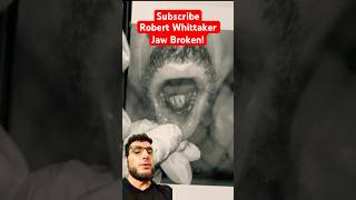 Robert Whittaker Jaw Injury Explained ufc shorts [upl. by Eddy986]