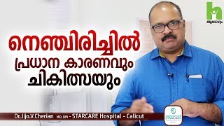 നെഞ്ചിരിച്ചിൽ പ്രധാന കാരണവും ചികിത്സയും  Acid reflux malayalam health tips [upl. by Eisak748]