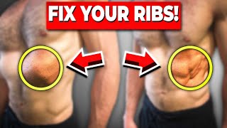 Fix Rib Flare In One Easy Exercise [upl. by Nolos]