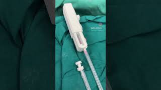 Ultrasound guided biopsy interventionalradiology youtubeshorts medicine cancer cancertreatment [upl. by Atsahc]