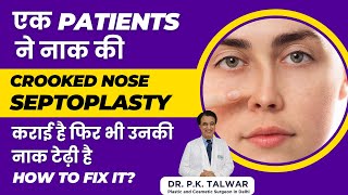 Septoplasty के बाद भी मेरी नाक टेढ़ीमेढ़ी क्यों दिखती है Nose Job in Delhi  Dr PK Talwar [upl. by Nnyleahs]