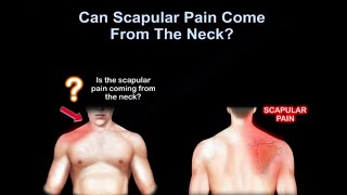 Neck pain or shoulder pain WHY IT HURTS [upl. by Daron]