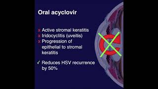 HEDS  Herpetic Eye Disease Study [upl. by Analah]