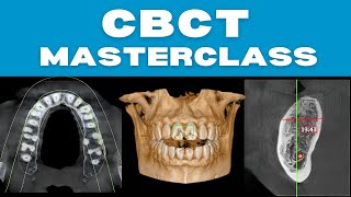 CBCT Masterclass With Real Case Discussions [upl. by Duma]