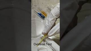 Oxidase test [upl. by Annaya]