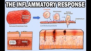 THE INFLAMMATORY RESPONSE [upl. by Coh]