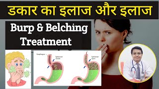 डकार ज्यादा आने का कारण डकार आने का कारण एवं इलाज  Burp prevention amp treatment belching treatment [upl. by Lotz127]