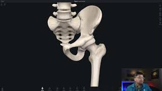 Hip CT measurements [upl. by Cyna]