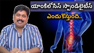 Ankylosing spondylitis problem and solution  యాంకిలోసిస్ స్పాండిలైటీస్ ఎందుకొస్తుంది [upl. by Aronaele]