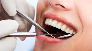 186 Labial Veneers Procedure [upl. by Emlyn969]