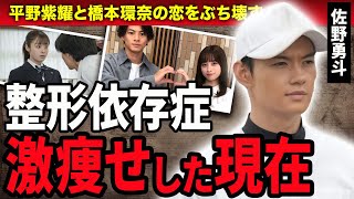 【衝撃】佐野勇斗が平野紫耀と橋本環奈の恋をぶち壊した理由…整形依存に陥り激痩せした現在に驚きが隠せない！『おむすび』でイケメン枠を演じた俳優の熱愛彼女の正体に驚愕！ [upl. by Goff564]