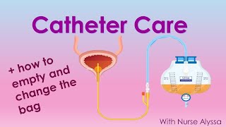 Catheter Care  how to change and clean the bag [upl. by Adianes]