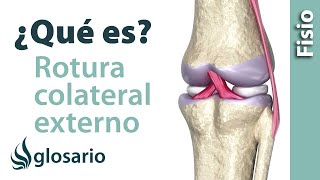 ROTURA DEL LIGAMENTO COLATERAL EXTERNO DE LA RODILLA  ¿Qué es [upl. by Dirraj693]