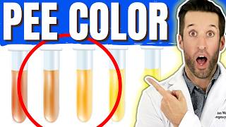 What Your Urine Says About Your Health 10 Signs You Shouldnt Ignore [upl. by Fisk]