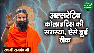 अल्सरेटिव कोलाइटिस की समस्या हुई ठीक  Ulcerative Colitis Treatment  Swami Ramdev JiHealth Mantra [upl. by Cuda842]