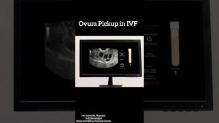 The Incredible Science Behind IVF Egg Retrieval [upl. by Snoddy86]