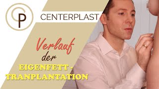 Eigenfetttransplantation  Wie verläuft sie [upl. by Leuqram]