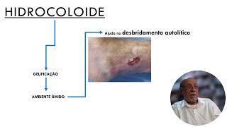 HIDROCOLOIDE Parte 2 [upl. by Atorod]