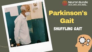 Shuffling Parkinson’s Gait  feature of parkinsonism gaitdisorders examination neurology [upl. by Nennarb]