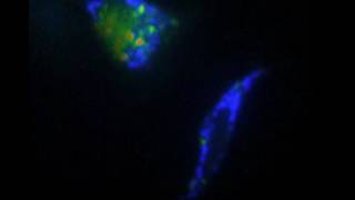 Caspase inhibition and mitophagy monitored by FRET in Hela cells undergoing apoptosis [upl. by Jori]