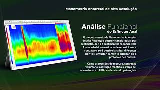 Você conhece nosso equipamento de Manometria de Alta Resolução de 24 Canais [upl. by Emmaline]